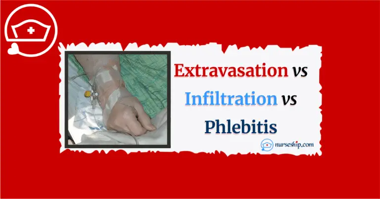 How Common Is Iv Infiltration