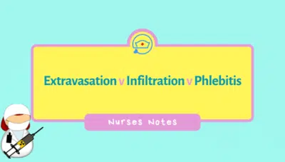 Extravasation-vs-Infiltration-vs-Phlebitisiv-extravasation-iv-infiltration