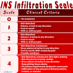 Extravasation vs Infiltration vs Phlebitis: Local Complications of ...