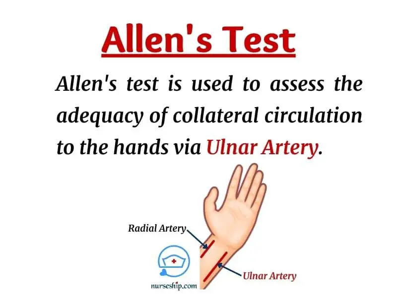 allen test-modified allen test-what is the allen test-allen test purpose-positive allen test-allen test result-