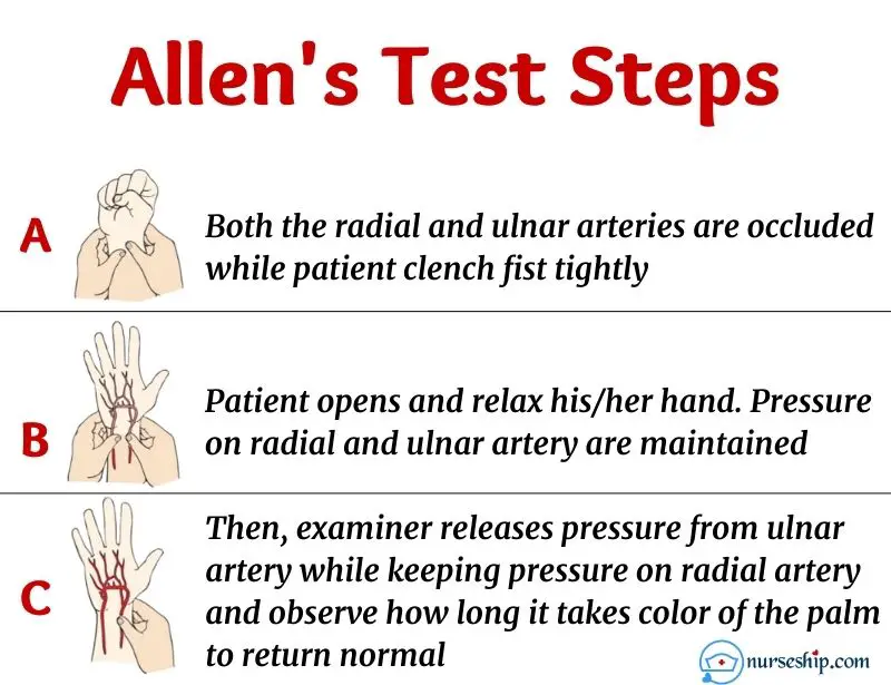 allen test-modified allen test-allen test steps-how to perform allen test-positive allen test-allen test positive-negative allen test-allen test steps nclex-mod allen test