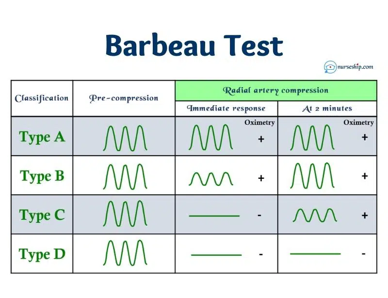 barbeau test- barbeau test radial artery- reverse barbeau test- how to perform barbeau test- barbeau test vs allen test