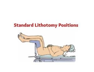 lithotomy position- dorsal lithotomy position- lithotomy position image- lithotomy position photo- dorsal lithotomy position picture- male lithotomy position