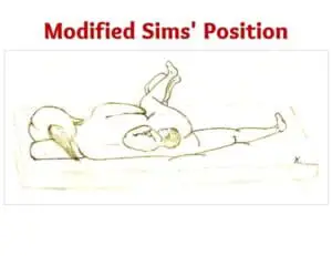 modified Sims position-modified sims position pictures- modified sims position images- modified left sims position