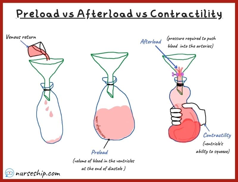 cardiac-preload-vs-afterload-vs-contractility-preload-vs-afterload-heart-what-is-preload-preload-definition -what-is-afterload-afterload-definition-contractility-definition-myocardial-contractility-what-is-contractility-easy-explanation-preload-vs-afterload-example-preload-vs-afterload-made-easy-preload-vs-afterload-all-nurse-preload-vs-afterload-vs-contractility-example