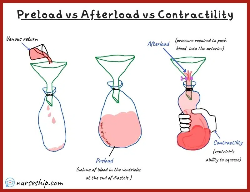cardiac-preload-vs-afterload-vs-contractility-preload-vs-afterload-heart-what-is-preload-preload-definition -what-is-afterload-afterload-definition-contractility-definition-myocardial-contractility-what-is-contractility-easy-explanation-preload-vs-afterload-example-preload-vs-afterload-made-easy-preload-vs-afterload-all-nurse-preload-vs-afterload-vs-contractility-example