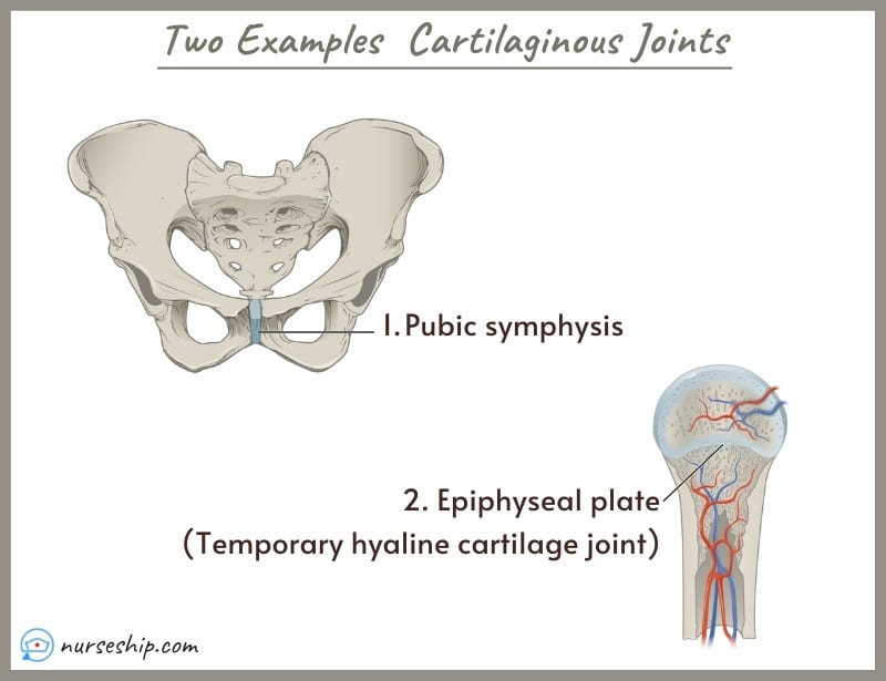 cartilaginous-joints- cartilaginous-joint-cartilaginous-joints-examples-cartilaginous-joints-are-types-of-cartilaginous-joints-cartilaginous-joints-quizlet-cartilaginous-joints-diagram-cartilaginous-joints-amphiarthrosis-amphiarthrotic-joints-synchondroses-symphyses-funcition-of-list-the-types-of-cartilaginous-joints-cartilaginous-joints-anatomy-cartilaginous-joints-definition