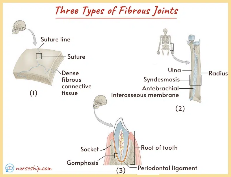 fibrous-joints-fibrous-joint-fibrous-joint-example-types-of-fibrous-joint-example-of-fibrous-joint-fibrous-joints-are-classified-as-synarthrotic-joints-example-of-synarthrotic-joints-types-of-fibrous-joint-what-is-a-fibrous-joint-gomphoses-syndesmoses- peg-and-socket-joint-example-of-a-synarthrotic-fibrous-joint-is-the-a-of-the-skull-is-an-example-of-an-immovable-fibrous-joint-what-is-an-example-of-a-fibrous-joint-a-fibrous-joint-that-is-a-peg-in-socket-is-called-a