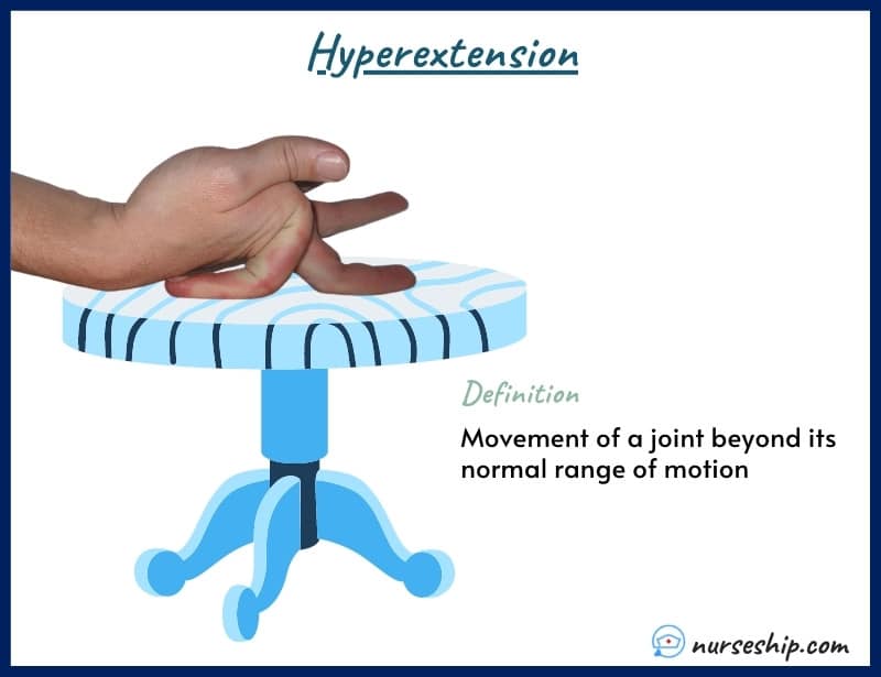 hyperextension-definition-anatomy-example-meaning-medical-image-with-pics-a&p-angular-movement-musculosckeletal-system-nursing-explain-motion-quizlet-joints-muscle-picture-what-is-medical-joints-anatomical-what-is-