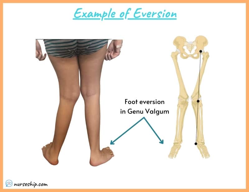 inversion-vs-eversion-in-anatomy-nurseship