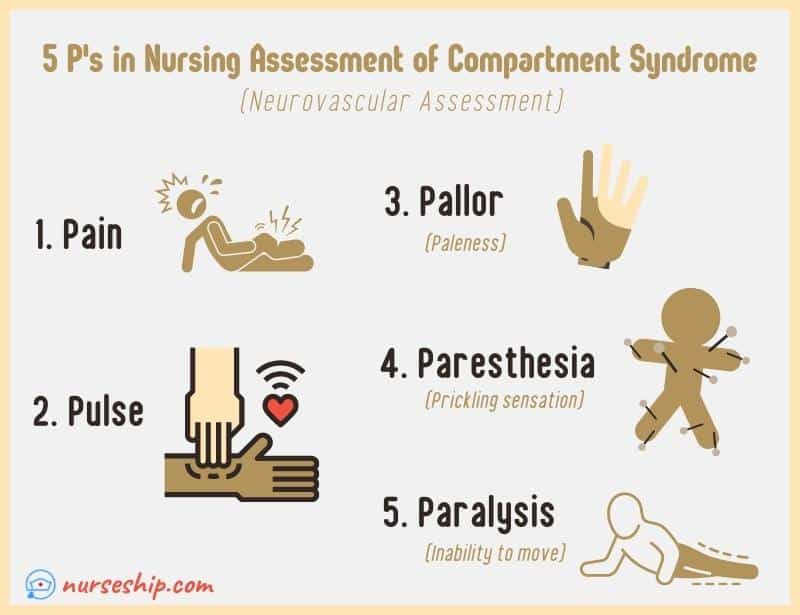 5-p’s-of-in-nursing-assessment-of-a-patient-with-a-fracture-five-ps-neurovascular-assessment-evaluation-pain-pallor-pulse-paresthesia-paralysis-compartment-syndrome-all-types-fractures-what-are-the-5-p's-of-nursing-stands-for-meaning-definition-image-diagram